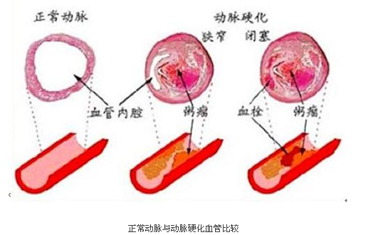 血管外科_血管脂肪瘤_血管外科收入(3)