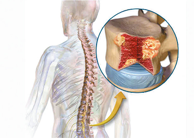 18年第10期健康版-15.jpg 18年第10期健康版-15.jpg
