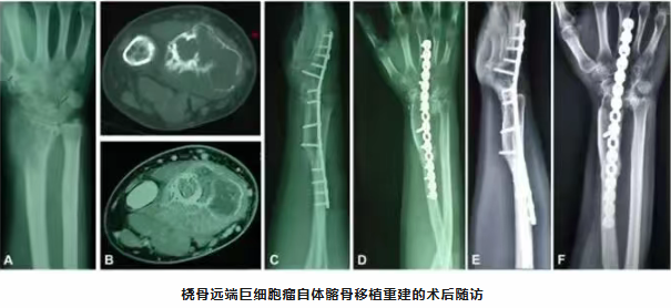 wechat_2025-11-26_140227_943.png wechat_2025-11-26_140227_943.png